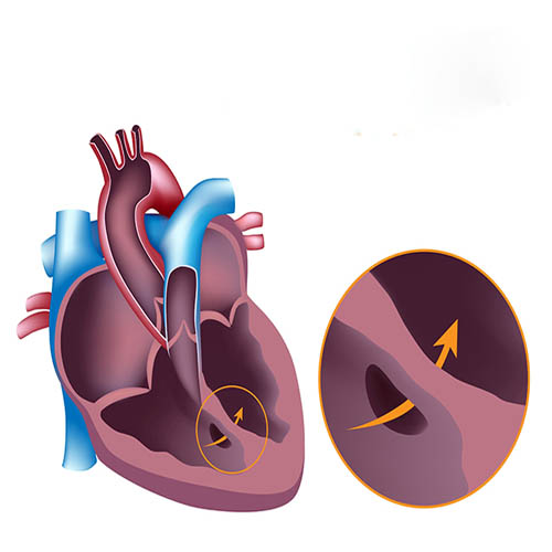 Best doctor for congenital heart diseases