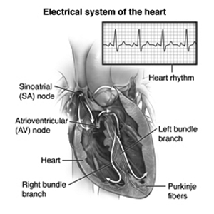 pacemaker implantation hospital in indore